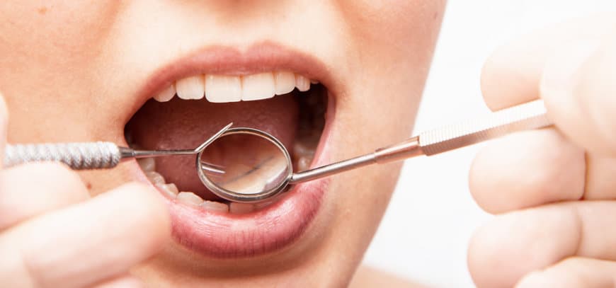 Sensibilidad Dental: Causas, Remedios y Tratamiento